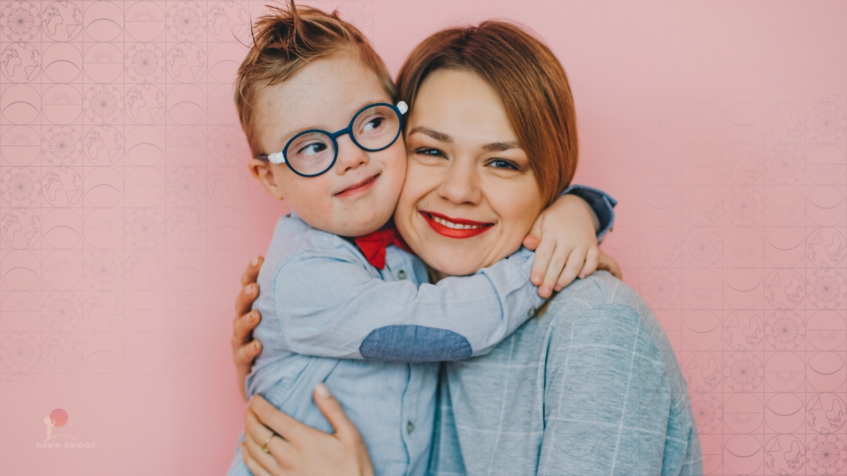 Trẻ nhỏ mắc hội chứng Down