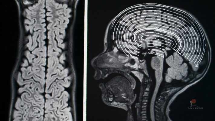 anh bia bai viet dong kinh o tre tu ky